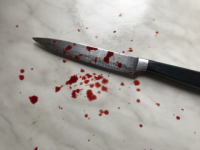 Полицейскому отрубили фалангу пальца во время драки в кафе в Лыскове  