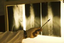 Новая рентген-установка поступила в поликлинику Кулебакской ЦРБ 